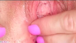 Thumb 8